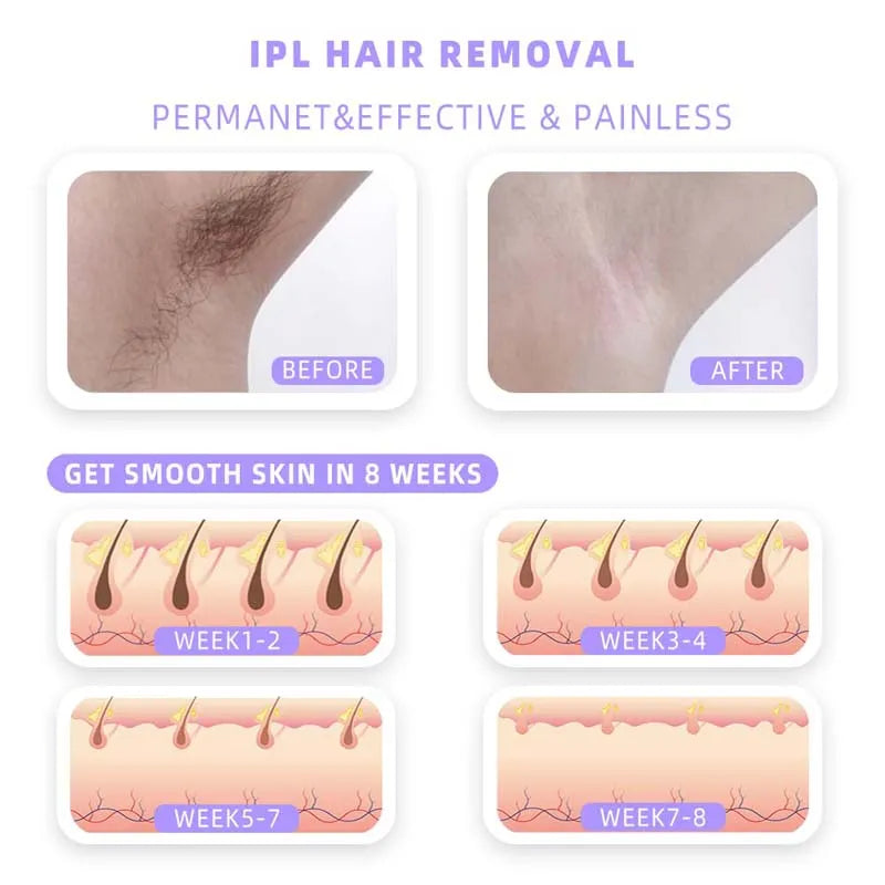 Ipl Hair Removal Laser Epilator 999900 Fast Flash Hair Remover Painless Permanent Photoepilator Whole Body Treament For Women